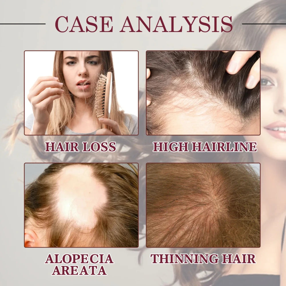 Red Onion Hair Growth Serum